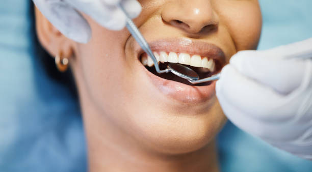 Best Emergency Gum Treatment in Los Luceros, NM